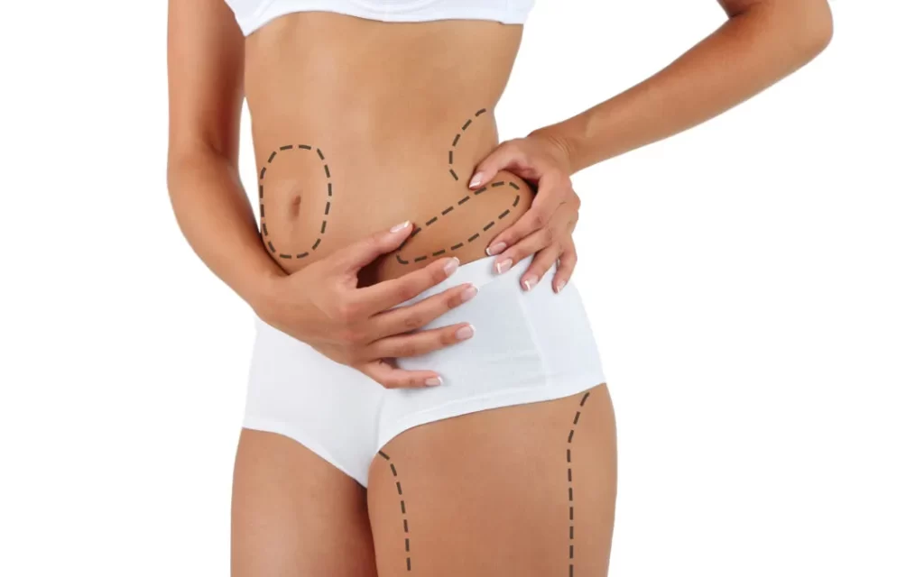 Body Contouring treatment clinic in Noida