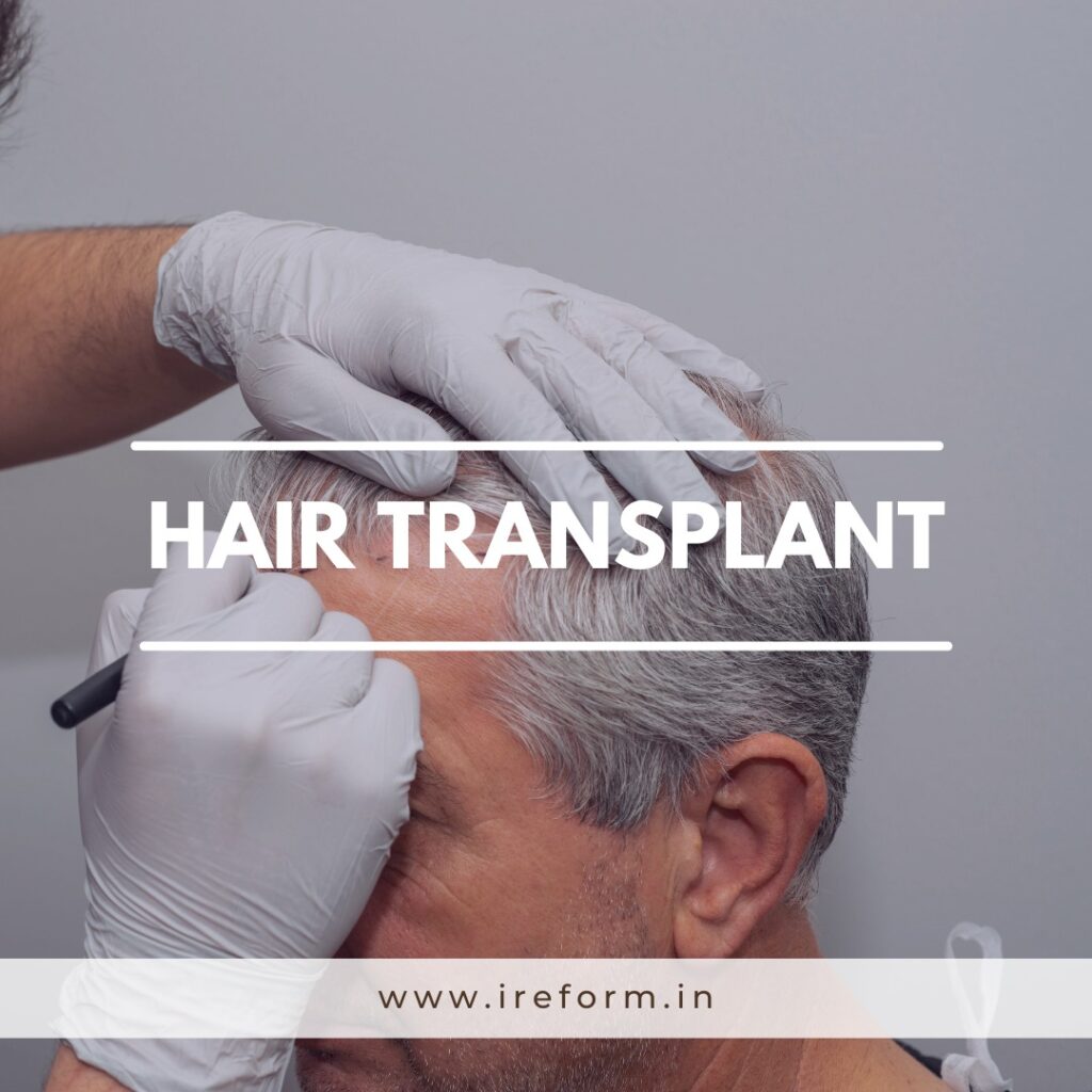 Hair Transplant in Winter