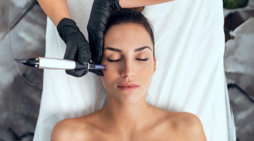 Laser Hair Removal Treatment Face