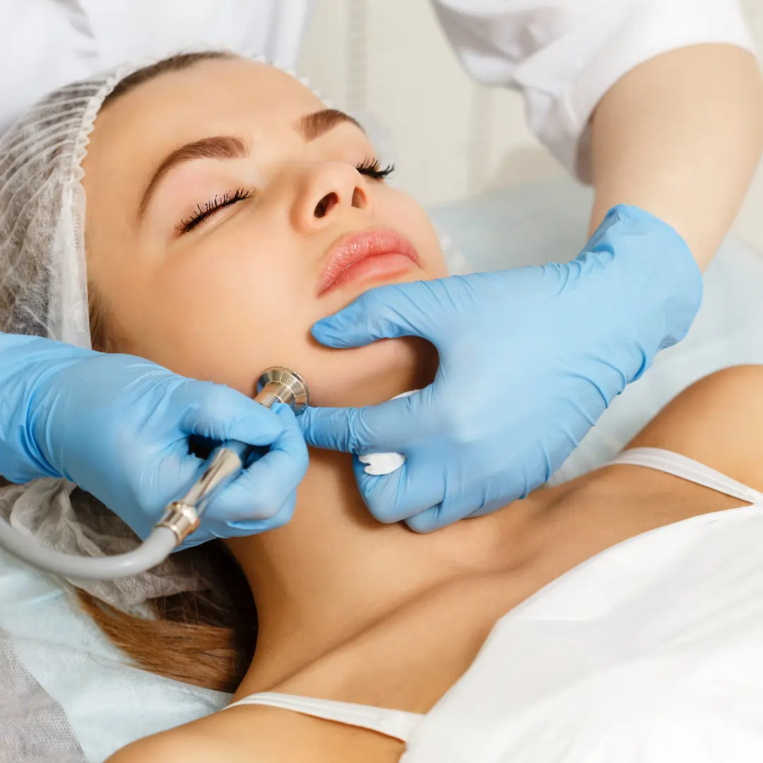 Microdermabrasion