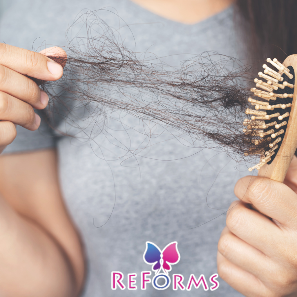 Is stress Reason For your hair fall ?